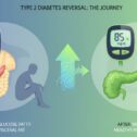 Reversal of Type 2 Diabetes