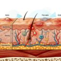Skin Disease